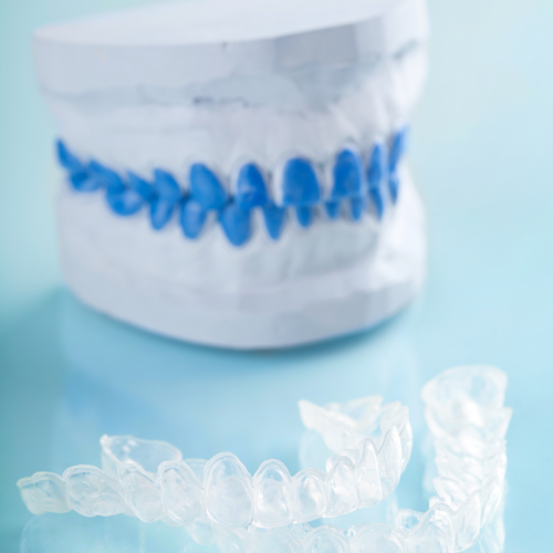 Bruxime et gouttières 