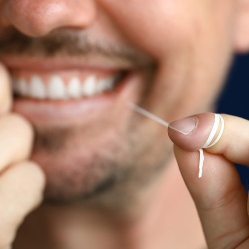 Caries interdentaires : prévention et traitement 