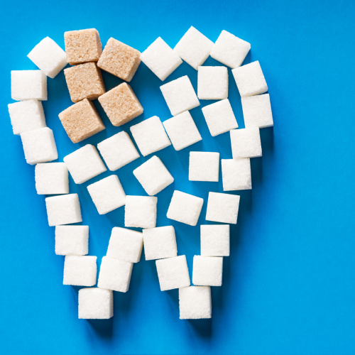 Comment prévenir les caries dentaires : conseils simples et efficaces