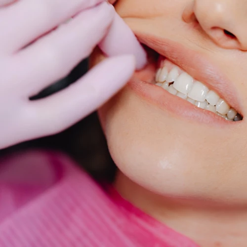 Dents qui s&rsquo;usent : comment reconna&icirc;tre l&rsquo;usure dentaire ?