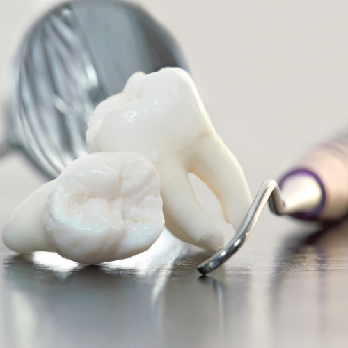 Est-il nécessaire d'extraire les dents de sagesse ?