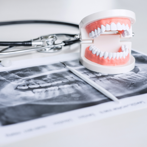 La radiographie dentaire : A quoi ça sert ?