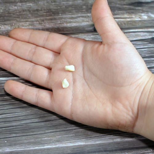 L’apparition des dents définitives