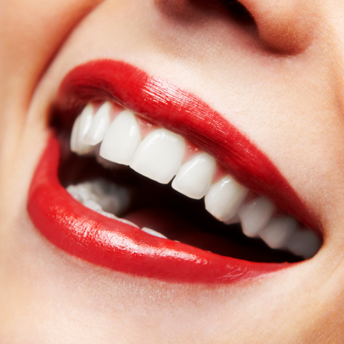 Le blanchiment des dents : quelles sont les options et les précautions à prendre ?