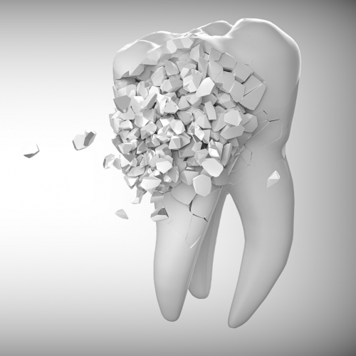 elfbar nachfüll pod läuft aus Taches sur les Dents de Lait : La Fluorose, Cause et traitement