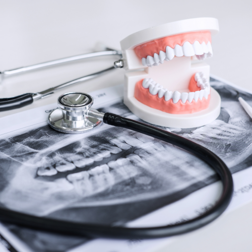 L'Impact d'une mauvaise hygiène bucco-dentaire sur les maladies systémiques