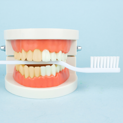 L'éclaircissement dentaire : Tout ce que vous devez savoir 