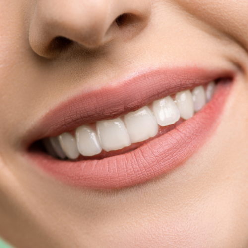 Pourquoi mes dents deviennent-elles transparentes?