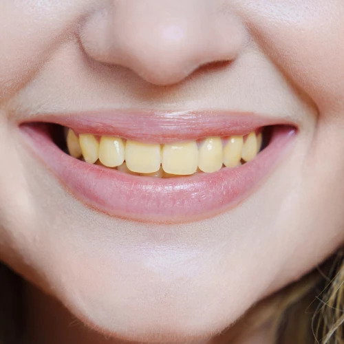 Pourquoi mes dents deviennent jaunes malgr&eacute; le brossage ?