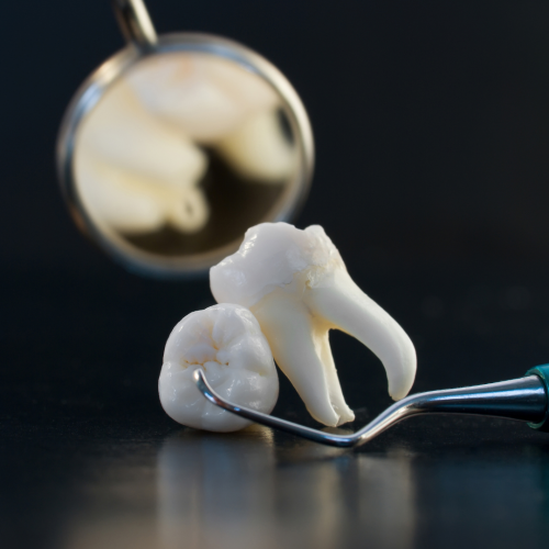 Que faire après une extraction des dents de sagesse ?