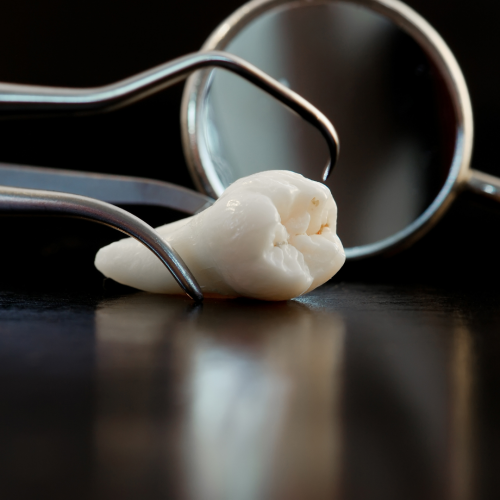 Symptomes de l'éruption des dents de sagesse 